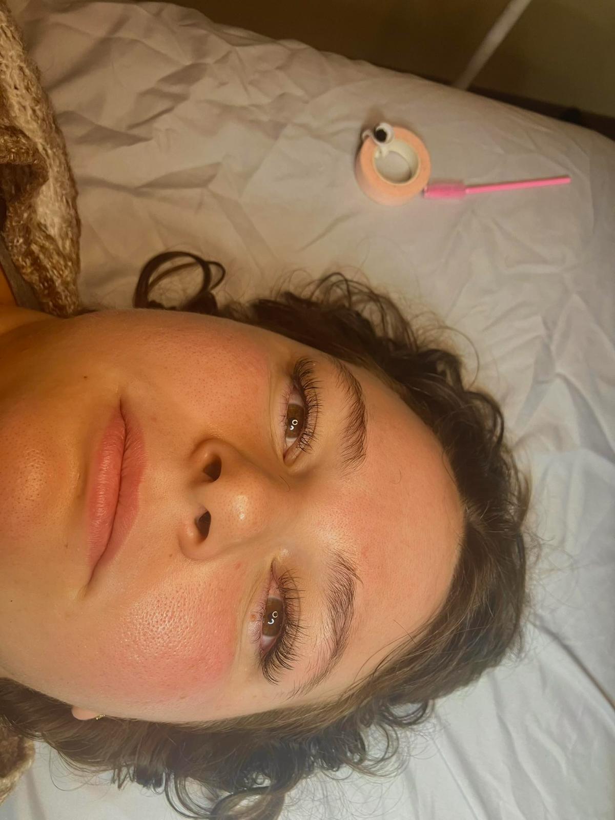 unnamed image